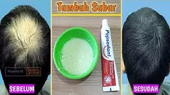 Penumbuh Rambut Super Cepat Tanpa Resiko.. - Durasi: 6.38. 