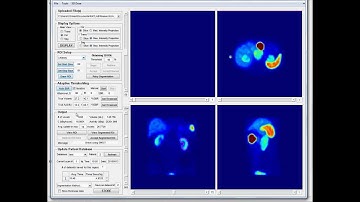 JADA tutorial 8 - The iterative adaptive thresholding method