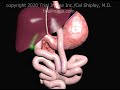 Gastric Bypass Surgery Roux-en-Y Animation by Cal Shipley, M.D.