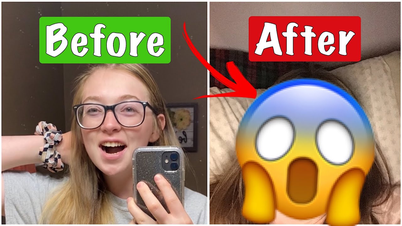 Getting My Wisdom Teeth Out!🦷 HILARIOUS REACTION🤣🤣🤣 YouTube