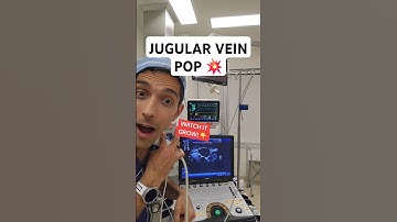 Halsader onder valsalva
