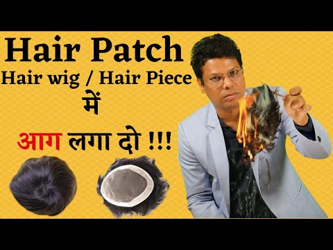 HAIR PATCH लगाने से पहले ये वीडियो ज़रूर देखें। WIG लगाने वाले सावधान !! Dr. Ashok Sinha