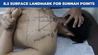 8.2 Surface Landmark for Sunnah Points