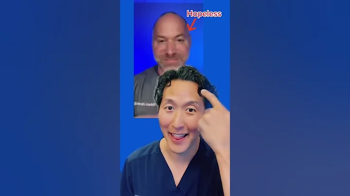 Natural Solutions for Thinning Hair!