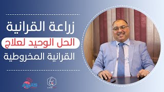 هل زراعة القرنية الحل الوحيد لعلاج القرنية المخروطية ؟ | د. هاني المكاوي