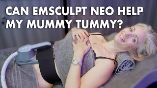 Can NEO Help My Mummy Tummy Hayley McQueen Tests the Treatment #mummytummy #emsculptneo
