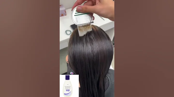 Lice removal treatment