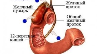 видео Заболевания желчного пузыря: симптомы, признаки, лечение болезни