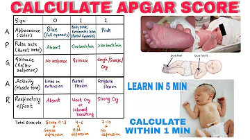 What is the full meaning of Apgar score?