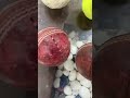 My ball collections