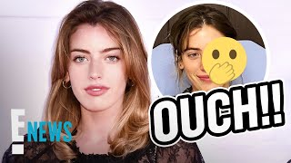 Celebrity Ewan McGregor's Daughter Clara's Face Bitten By Dog Before Premiere | E! News Wealth