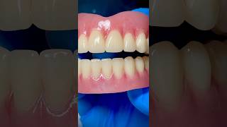 Full denture with detailed cosmetic characteristics for Dr. Archie Cook in North Carolina