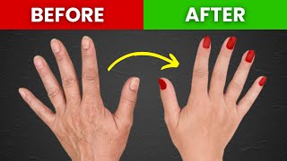 #1 Top Remedy for Dry and Wrinkled Hands and Skin