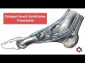 How to Treat Compartment Syndrome with Chair Massage Techniques