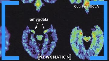 Brain fog? Here’s how to beat it | Banfield