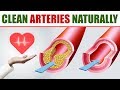 17 Best Foods To Clean and Unclog Arteries Naturally and Help Prevent Heart Attacks