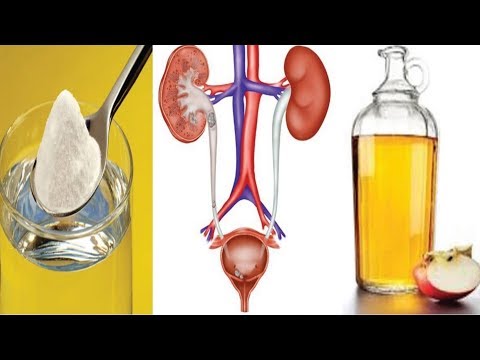 How to Treat a Urinary Tract Infection With ACV And Baking Soda!