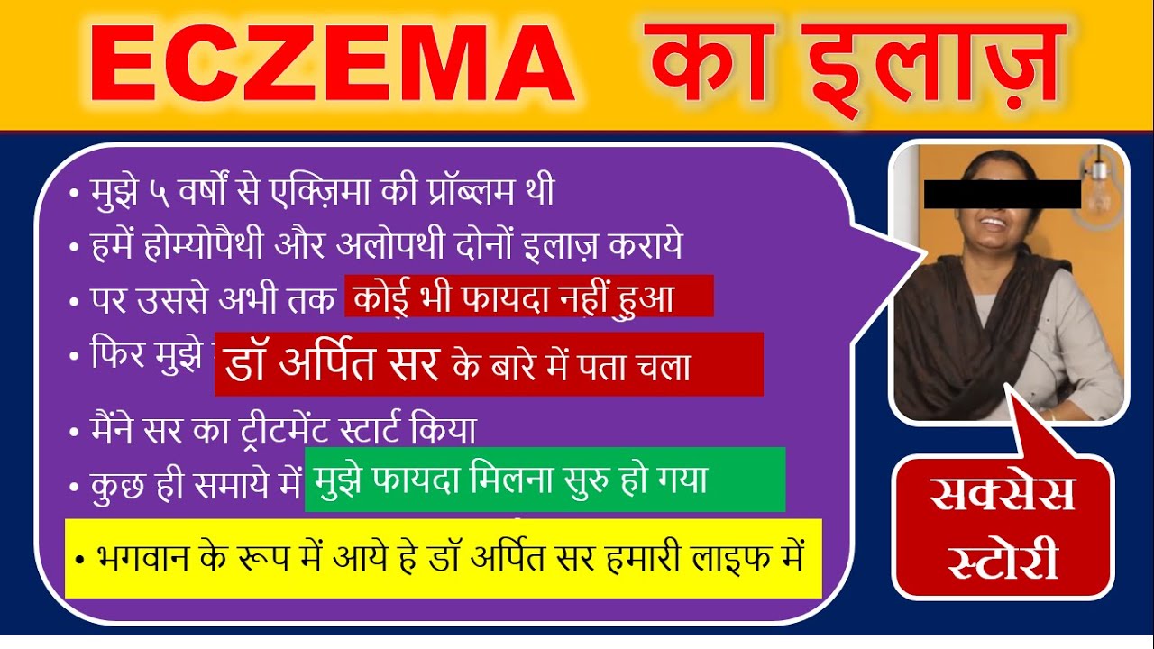 Permanent Cure For Eczema एक्जिमा का होम्योपैथिक इलाज Dr. Arpit