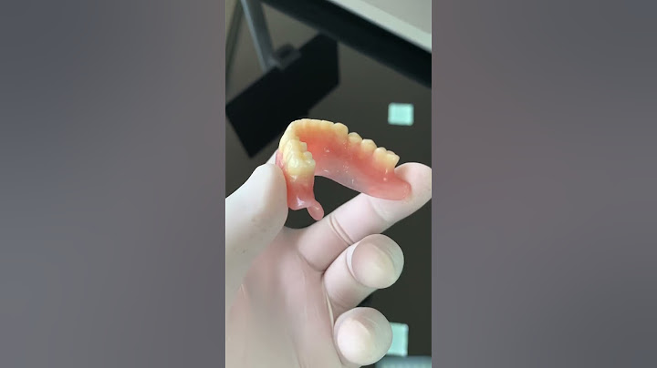 Logramos crear la mejor adherencia de una prótesis total inferior en boca 😃🎉🎉