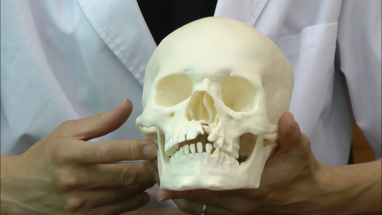 口蓋裂症を持つ男児の頭蓋骨模型 9 3 Youtube