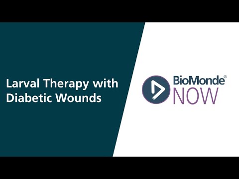 Larval Therapy with Diabetic Wounds | Wound Care Case Study - video from BioMonde