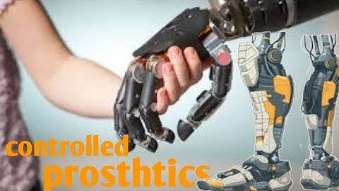 How mind controlled Bionic Arms fuse to the body #engineering