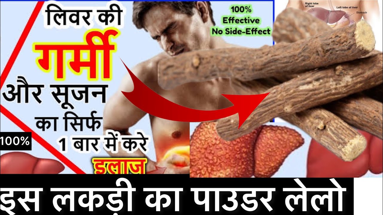 लिवर की गर्मी को कैसे सही करे LIVER HEAT POWDER liver heat causes