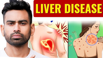 3 Early Signs That Your Liver is DYING (With Solution)
