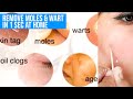 i Remove My Moles & Wart in 1 sec at home | read description & pin comment | not Use direct on face