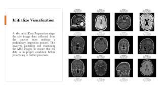 Innovative Transfer Learning Technique for Brain Tumor Diagnosis - Naufal Nazaruddin - Paper