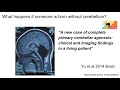 Wk 33 what is the role of cerebellum for consciousness