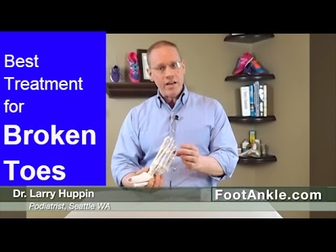 Video: Broken Toe: Příznaky, Zotavení A Další