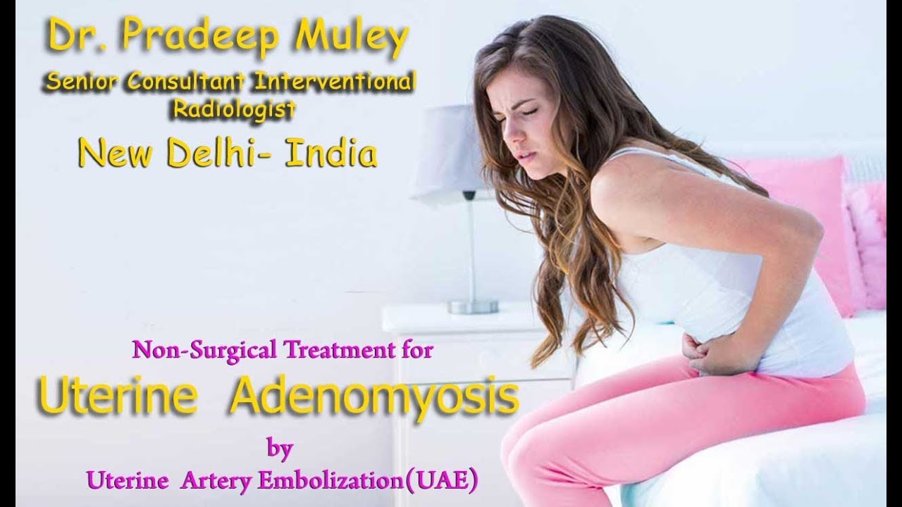 Adenomyosis - what is it And how to treat it Adenomyosis - what is it And how to treat it
