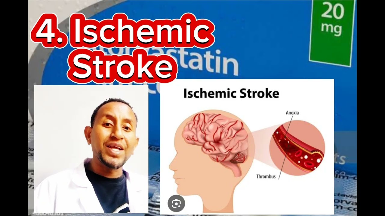 Atrovastatin Drug @Lishan Tube MSc Shimeles Tesfaye @Donkey Tube