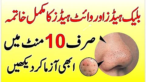 How To Remove Black And Whiteheads At Home In Urdu...
