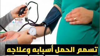 تسمم الحمل💊 pre eclampsia أعراضه وتشخيصه وعلاجه  #pregnancy #الأدوية #اختبار_الحمل #ABC_صيدلة