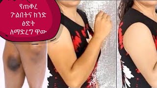 . የጠቆረ ጉልበትና ክንድ ፅድት ለማድረግ ዋው   For a dark knee and elbow, watch this