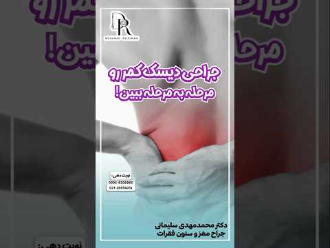جراحی دیسک کمر رو مرحله به مرحله ببین شماره تماس مطب 09058206860