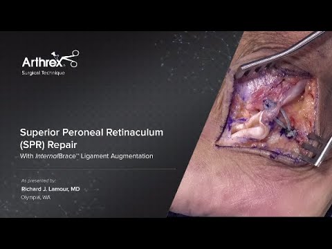 Video: Superior Peroneal Retinaculum Anatomija, Funkcija In Diagram - Body Maps