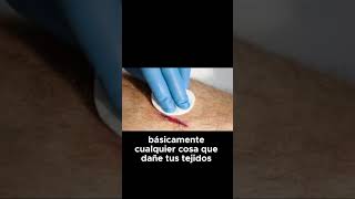 Descubre las Dos Caras del Dolor: Agudo vs Crónico #Dolor #Salud #Medicina #DolorAgudo #DolorCrónico