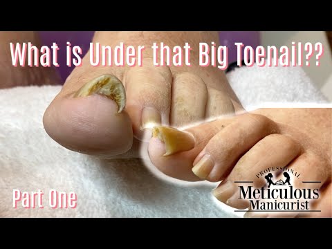 👣 Take Care of Your Toenail Pain at Home Online Ingrown Pedicure Lesson 👣