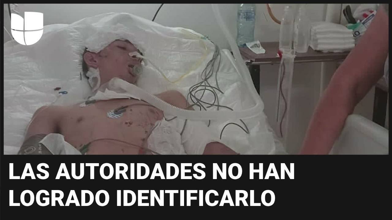 Migrante pierde las piernas tras caer del tren 'La Bestia': está inconsciente en hospital de México