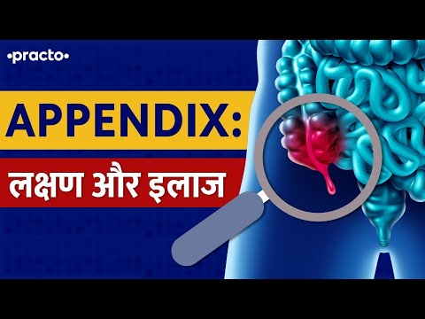 Appendix: What Are Symptoms Of Appendicitis | Appendicitis Treatment | Practo