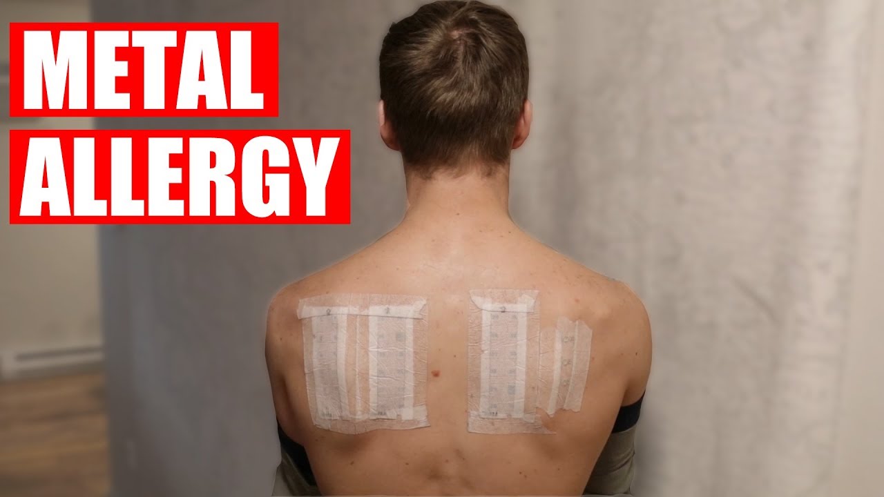 How to Test for Metal Allergies YouTube How to Test for Metal Allergies YouTube
