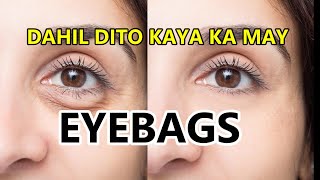 EYEBAG : PAANO MO ALISIN ANG EYEBAG OR DARK CIRCLE