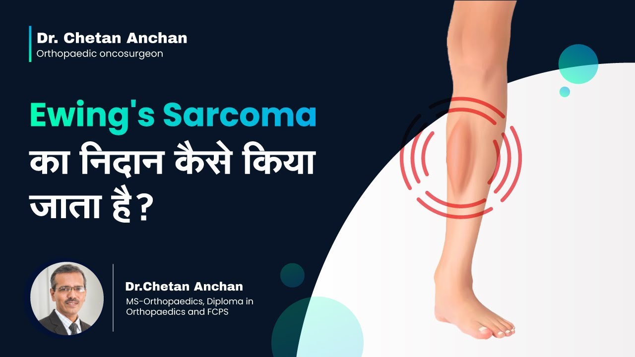 Ewing's Sarcoma का निदान कैसे किया जाता है? | How is Ewing's Sarcoma Diagnosed? | Dr. Chet