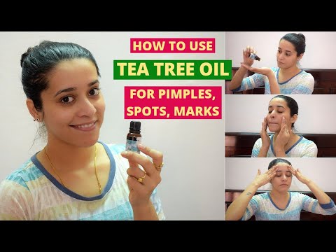 How To Use TEA TREE OIL For PIMPLE, ACNE, PIMPLE SPOTS, BLEMISHES | Just another girl