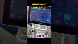 Respiración de Cheyne-Stokes 👌💯🎯#fisiología #Respiración