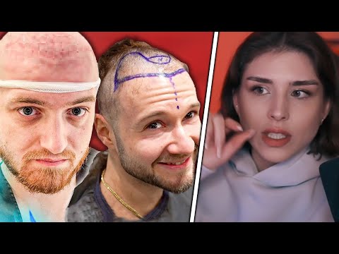 DER HAARTRANSPLANTATION TREND 😲 | REAKTION auf KLENGAN