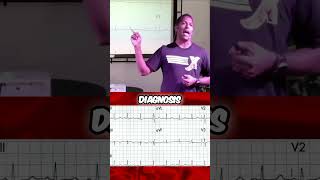 Hypocalcemia on the ECG? Anand Swaminathan, MD (@emswami) from ResusX:ReUnion explains. #shorts